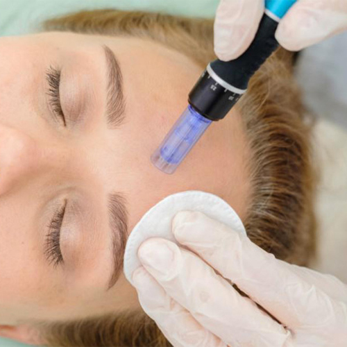 Phi kim tế bào gốc bằng Máy Dr Pen A1 Phi kim tế bào gốc bằng Máy Dr Pen A1