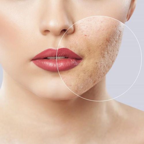 5 lời khuyên hữu ích để phục hồi da mặt hư tổn 5 lời khuyên hữu ích để phục hồi da mặt hư tổn