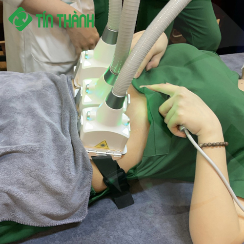 Giảm mỡ bụng bằng Máy giảm béo Sculpt Laser 1060 Giảm mỡ bụng bằng Máy giảm béo Sculpt Laser 1060