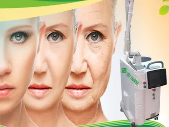 Công nghệ Laser CO2 Fractional có tốt không ?