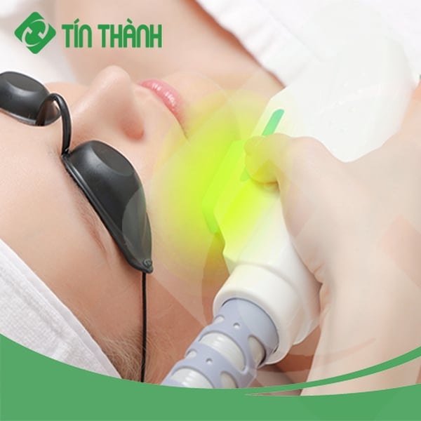 Máy triệt lông K3