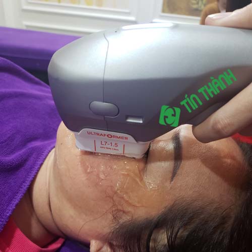 Khách hàng Tín Thành điều trị trẻ hoá da bằng công nghệ Hifu Shurink cho khách hàng Khách hàng Tín Thành điều trị trẻ hoá da bằng công nghệ Hifu Shurink cho khách hàng