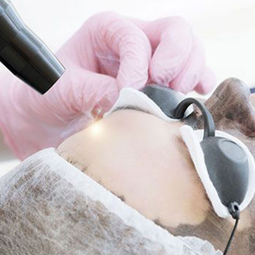 Trẻ hóa da bằng than hoạt tính Trẻ hóa da bằng than hoạt tính