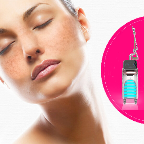 Trị nám da bằng laser có hiệu quả không ? Trị nám da bằng laser có hiệu quả không ?