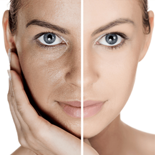 Các phương pháp trị nám tận gốc tại nhà hiệu quả Các phương pháp trị nám tận gốc tại nhà hiệu quả