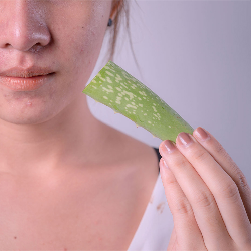 Biện pháp trị sẹo mụn bằng nha đam tại nhà hiệu quả Biện pháp trị sẹo mụn bằng nha đam tại nhà hiệu quả