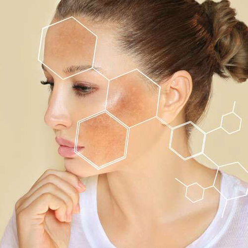 Các phương pháp xóa sẹo thâm tốt nhất Các phương pháp xóa sẹo thâm tốt nhất