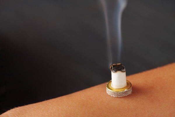 Cứu mồi ngải Cứu mồi ngải