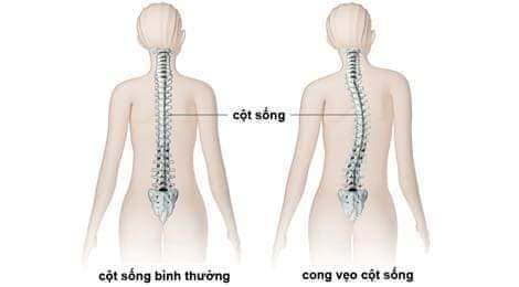 Mục đích tác động cột sống Mục đích tác động cột sống