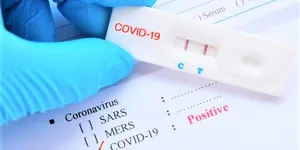 Kit test nhanh Covid-19 nào được Bộ Y tế cấp phép?