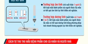 Cách tự lấy mẫu xét nghiệm nhanh vi-rút SARS-COV-2 tại nhà