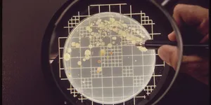 CFU là gì? Cách tính CFU như thế nào?