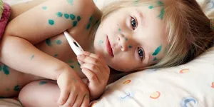 Xử Lý Khi Ngộ độc Cloramin B