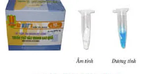 Hướng dẫn sử dụng kit kiểm tra nhanh dư lượng thuốc trừ sâu VPR10