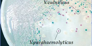 Hướng dẫn cách sử dụng đĩa thạch chứa môi trường TCBS Agar để kiểm tra nước ao nuôi