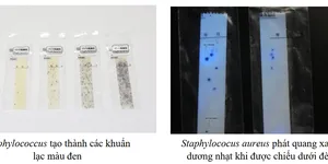 CÁCH SỬ DỤNG GIẤY PHÁT HIỆN STAPHYLOCOCCUS- SUNCOLI (LOẠI 02)