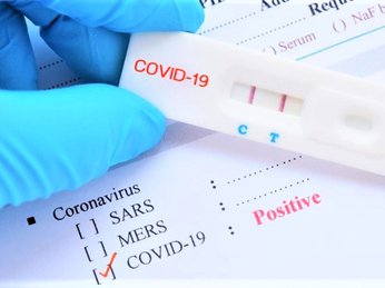 Kit test nhanh Covid-19 nào được Bộ Y tế cấp phép?
