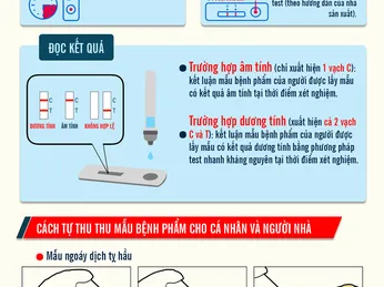 Cách tự lấy mẫu xét nghiệm nhanh vi-rút SARS-COV-2 tại nhà