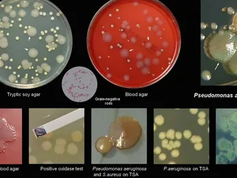 SINH VẬT HIẾU KHÍ LÀ GÌ? HƯỚNG DẪN PHÁT HIỆN VI KHUẨN HIẾU KHÍ BẰNG GIẤY TEST SUNCOLI (LOẠI 03)