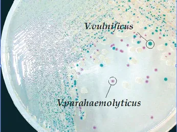 Hướng dẫn cách sử dụng đĩa thạch chứa môi trường TCBS Agar để kiểm tra nước ao nuôi