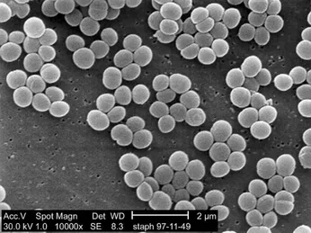 VI KHUẨN STAPHYLOCOCCUS TÁC NHÂN GÂY NGỘ ĐỘC THỰC PHẨM- HƯỚNG DẪN GIẤY PHÁT HIỆN STAPHYLOCOCCUS