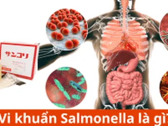 Vi khuẩn Salmonella là gì?Dấu hiệu nhận biết - Giấy thử nhanh Salmonella