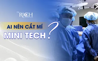 Ai nên cắt mí Mini Tech?
