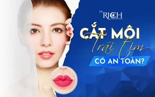 Cắt môi trái tim có an toàn?