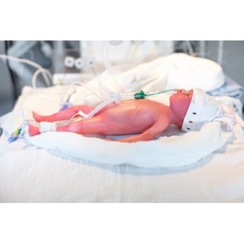 Mô hình mô phỏng cấp cứu hồi sức trẻ sơ sinh sinh non LAERDAL