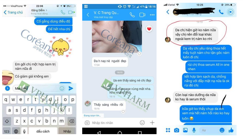 kem trị nám tàn nhang Nacos Hàn Quốc giá bao nhiêu