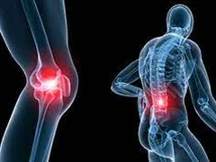 Cách chăm sóc và điều trị hiệu quả các bệnh về xương khớp